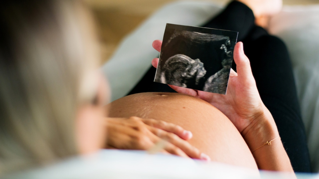 Alabama Senate approves presumptive Medicaid bill for pregnant mothers until 2028