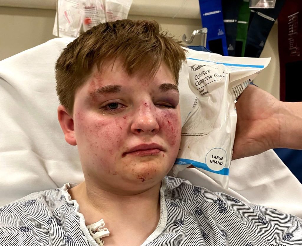 Man, juvenile indicted for hate crime in alleged lesbian attack