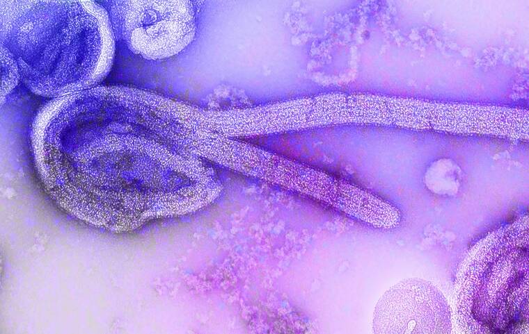 Experts say lack of U.S. involvement hindered Ebola response