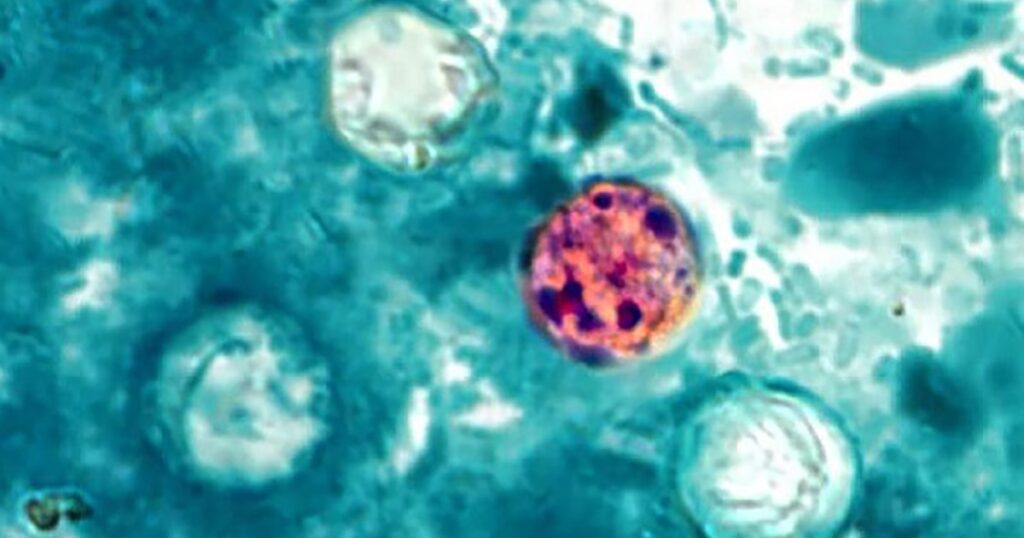 Voices: What Utahns need to know about cyclospora
