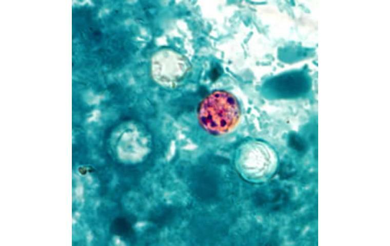 CDC expands largest known cyclospora outbreak to 15 states